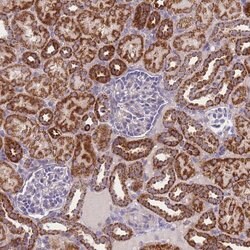 Invitrogen MRPS11 Polyclonal Antibody 100 &mu;L; Unconjugated:Antibodies,