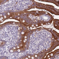 Invitrogen HOOK2 Polyclonal Antibody 100 &mu;L; Unconjugated:Antibodies,