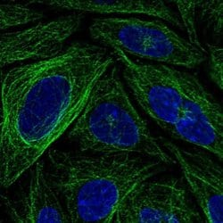 Invitrogen FBXL20 Polyclonal Antibody 100 &mu;L; Unconjugated:Antibodies,