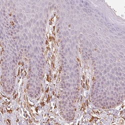 Invitrogen RCN3 Polyclonal Antibody 100 &mu;L | Buy Online | Invitrogen&trade; | Fisher Scientific