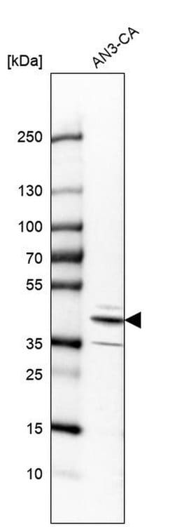 Invitrogen RCN3 Polyclonal Antibody 100 &mu;L | Buy Online | Invitrogen&trade; | Fisher Scientific