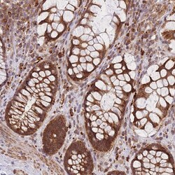 Invitrogen MRPL23 Polyclonal Antibody 100 &mu;L; Unconjugated:Antibodies,