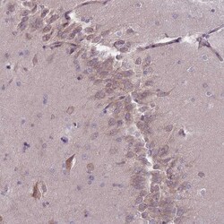Invitrogen PNPLA5 Polyclonal Antibody 100 &mu;L; Unconjugated:Antibodies,