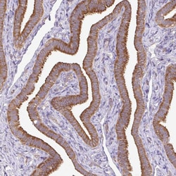 Invitrogen RPL28 Polyclonal Antibody 100 &mu;L | Buy Online | Invitrogen&trade; | Fisher Scientific