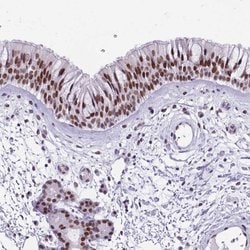 Invitrogen TBC1D26 Polyclonal Antibody 100 &mu;L; Unconjugated:Antibodies,