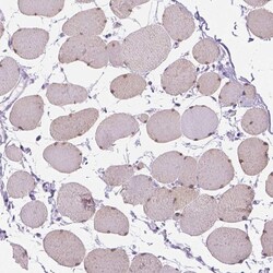Invitrogen TMEM38A Polyclonal Antibody 100 &mu;L; Unconjugated:Antibodies,