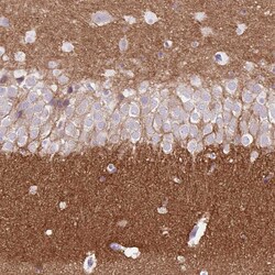 Invitrogen DPP6 Polyclonal Antibody 100 &mu;L; Unconjugated:Antibodies,