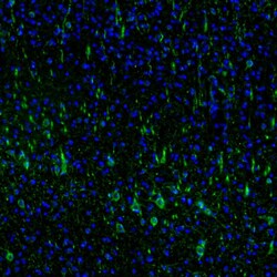Invitrogen DPP6 Polyclonal Antibody 100 &mu;L; Unconjugated:Antibodies,