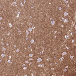 Invitrogen DPP6 Polyclonal Antibody 100 &mu;L; Unconjugated:Antibodies,