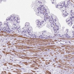 Invitrogen DPP6 Polyclonal Antibody 100 &mu;L; Unconjugated:Antibodies,