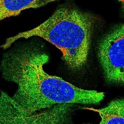 Invitrogen STEAP3 Polyclonal Antibody 100 &mu;L; Unconjugated:Antibodies,