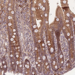 Invitrogen STEAP3 Polyclonal Antibody 100 &mu;L; Unconjugated:Antibodies,