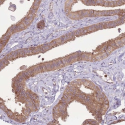 Invitrogen STEAP3 Polyclonal Antibody 100 &mu;L; Unconjugated:Antibodies,