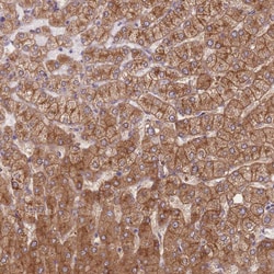 Invitrogen STEAP3 Polyclonal Antibody 100 &mu;L; Unconjugated:Antibodies,