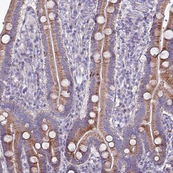 Invitrogen HSD3B7 Polyclonal Antibody 100 &mu;L; Unconjugated:Antibodies,