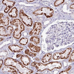 Invitrogen HSD3B7 Polyclonal Antibody 100 &mu;L; Unconjugated:Antibodies,