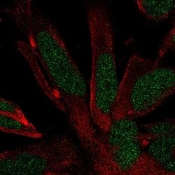 Invitrogen RFX4 Polyclonal Antibody 100 &mu;L; Unconjugated:Antibodies,