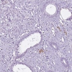 Invitrogen RFX4 Polyclonal Antibody 100 &mu;L; Unconjugated:Antibodies,