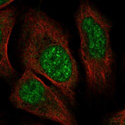 Invitrogen ZNF304 Polyclonal Antibody 100 &mu;L; Unconjugated:Antibodies,