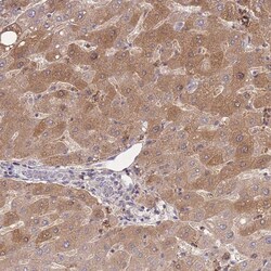 Invitrogen ZNF304 Polyclonal Antibody 100 &mu;L; Unconjugated:Antibodies,