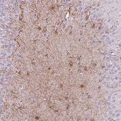 Invitrogen ZNF311 Polyclonal Antibody 100 &mu;L | Buy Online | Invitrogen&trade; | Fisher Scientific