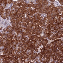 Invitrogen NDUFAF6 Polyclonal Antibody 100 &mu;L; Unconjugated:Antibodies,