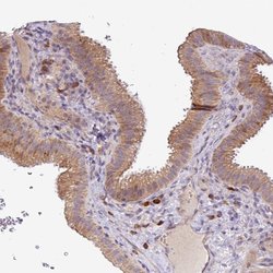 Invitrogen TM2D2 Polyclonal Antibody 100 &mu;L; Unconjugated:Antibodies,
