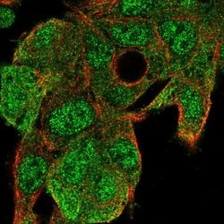 Invitrogen UBE2G1 Polyclonal Antibody 100 &mu;L | Buy Online | Invitrogen&trade; | Fisher Scientific