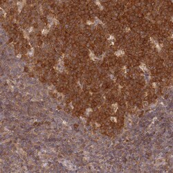 Invitrogen UBE2G1 Polyclonal Antibody 100 &mu;L | Buy Online | Invitrogen&trade; | Fisher Scientific
