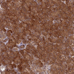Invitrogen UBE2G1 Polyclonal Antibody 100 &mu;L | Buy Online | Invitrogen&trade; | Fisher Scientific