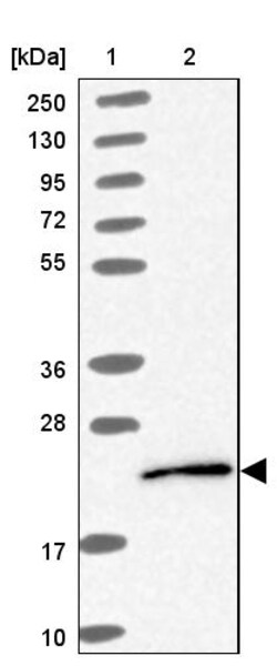 Invitrogen UBE2G1 Polyclonal Antibody 100 &mu;L | Buy Online | Invitrogen&trade; | Fisher Scientific