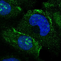 Invitrogen MAK16 Polyclonal Antibody 100 &mu;L; Unconjugated:Antibodies,