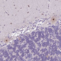 Invitrogen MAK16 Polyclonal Antibody 100 &mu;L; Unconjugated:Antibodies,
