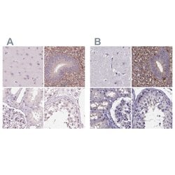 Invitrogen SFRP4 Polyclonal Antibody 100 &mu;L; Unconjugated:Antibodies,