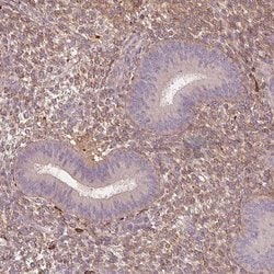 Invitrogen SFRP4 Polyclonal Antibody 100 &mu;L; Unconjugated:Antibodies,