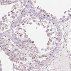 Invitrogen SFRP4 Polyclonal Antibody 100 &mu;L; Unconjugated:Antibodies,