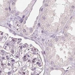 Invitrogen SFRP4 Polyclonal Antibody 100 &mu;L; Unconjugated:Antibodies,