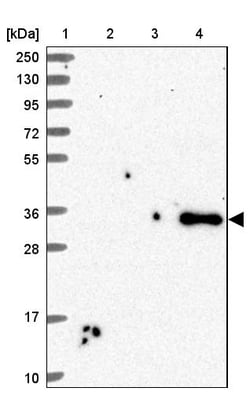Invitrogen SFRP4 Polyclonal Antibody 100 &mu;L; Unconjugated:Antibodies,