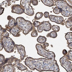 Invitrogen FENS1 Polyclonal Antibody 100 &mu;L; Unconjugated:Antibodies,