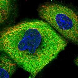 Invitrogen CCDC112 Polyclonal Antibody 100 &mu;L; Unconjugated:Antibodies,