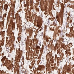 Invitrogen CCDC112 Polyclonal Antibody 100 &mu;L; Unconjugated:Antibodies,