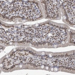 Invitrogen MRPS12 Polyclonal Antibody 100 &mu;L; Unconjugated:Antibodies,