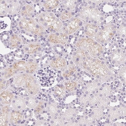 Invitrogen IGFBP-1 Polyclonal Antibody 100 &mu;L; Unconjugated:Antibodies,