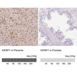 Invitrogen IGFBP-1 Polyclonal Antibody 100 &mu;L; Unconjugated:Antibodies,