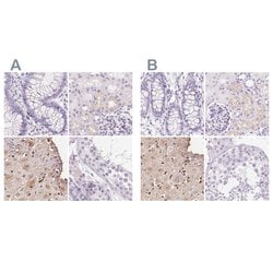 Invitrogen IGFBP-1 Polyclonal Antibody 100 &mu;L; Unconjugated:Antibodies,