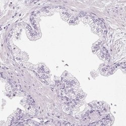 Invitrogen IGFBP-1 Polyclonal Antibody 100 &mu;L; Unconjugated:Antibodies,