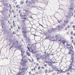 Invitrogen IGFBP-1 Polyclonal Antibody 100 &mu;L; Unconjugated:Antibodies,