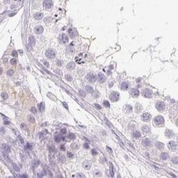 Invitrogen IGFBP-1 Polyclonal Antibody 100 &mu;L; Unconjugated:Antibodies,