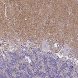 Invitrogen TTYH1 Polyclonal Antibody 100 &mu;L; Unconjugated:Antibodies,