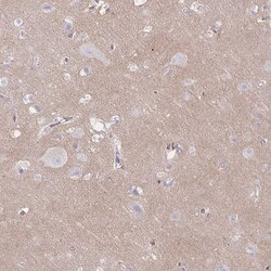 Invitrogen TTYH1 Polyclonal Antibody 100 &mu;L; Unconjugated:Antibodies,